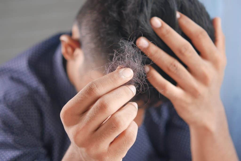 （頭皮毛囊炎嚴重的話會導致脫法、甚至永久性禿頭，所以請務必好好治療頭皮毛囊炎與照顧頭皮。圖片來源：Unsplash。）
